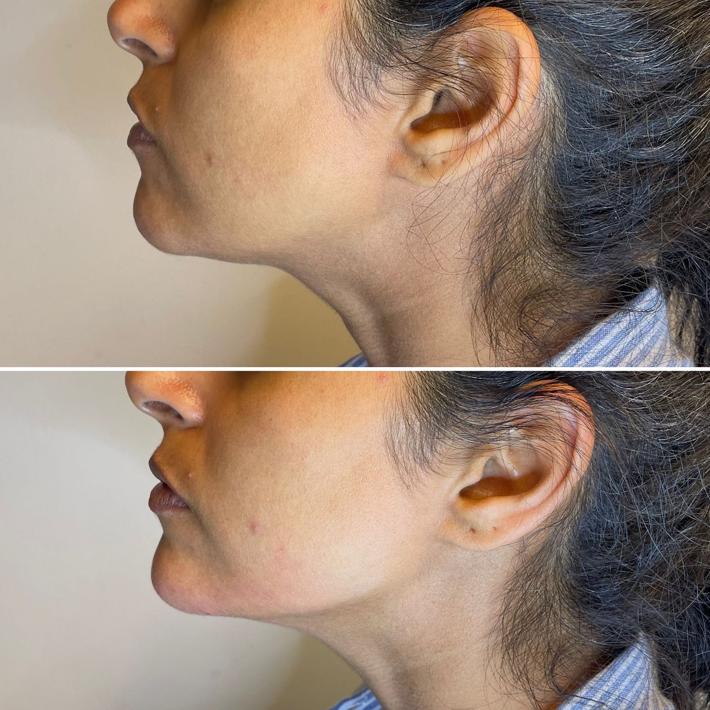 Before and after beautification