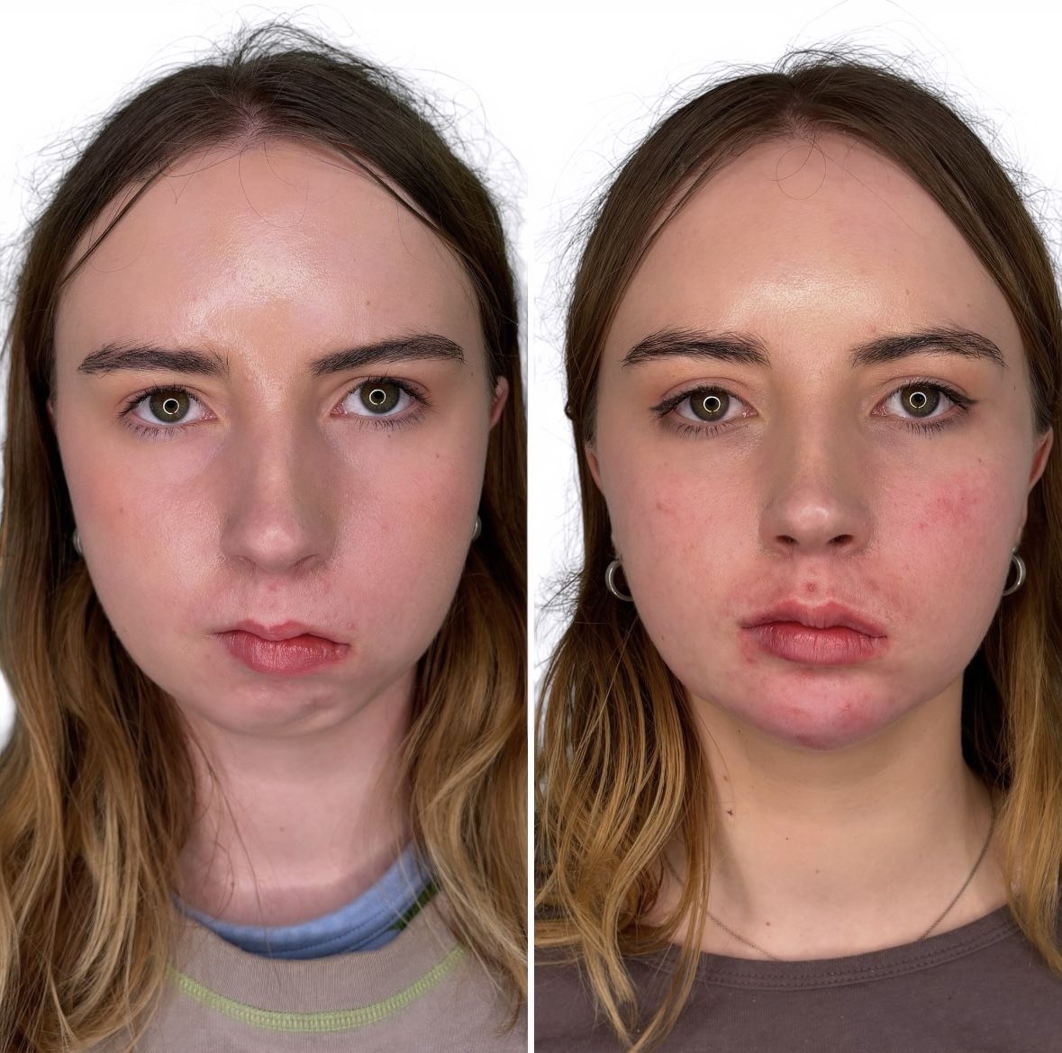 Before and after beautification