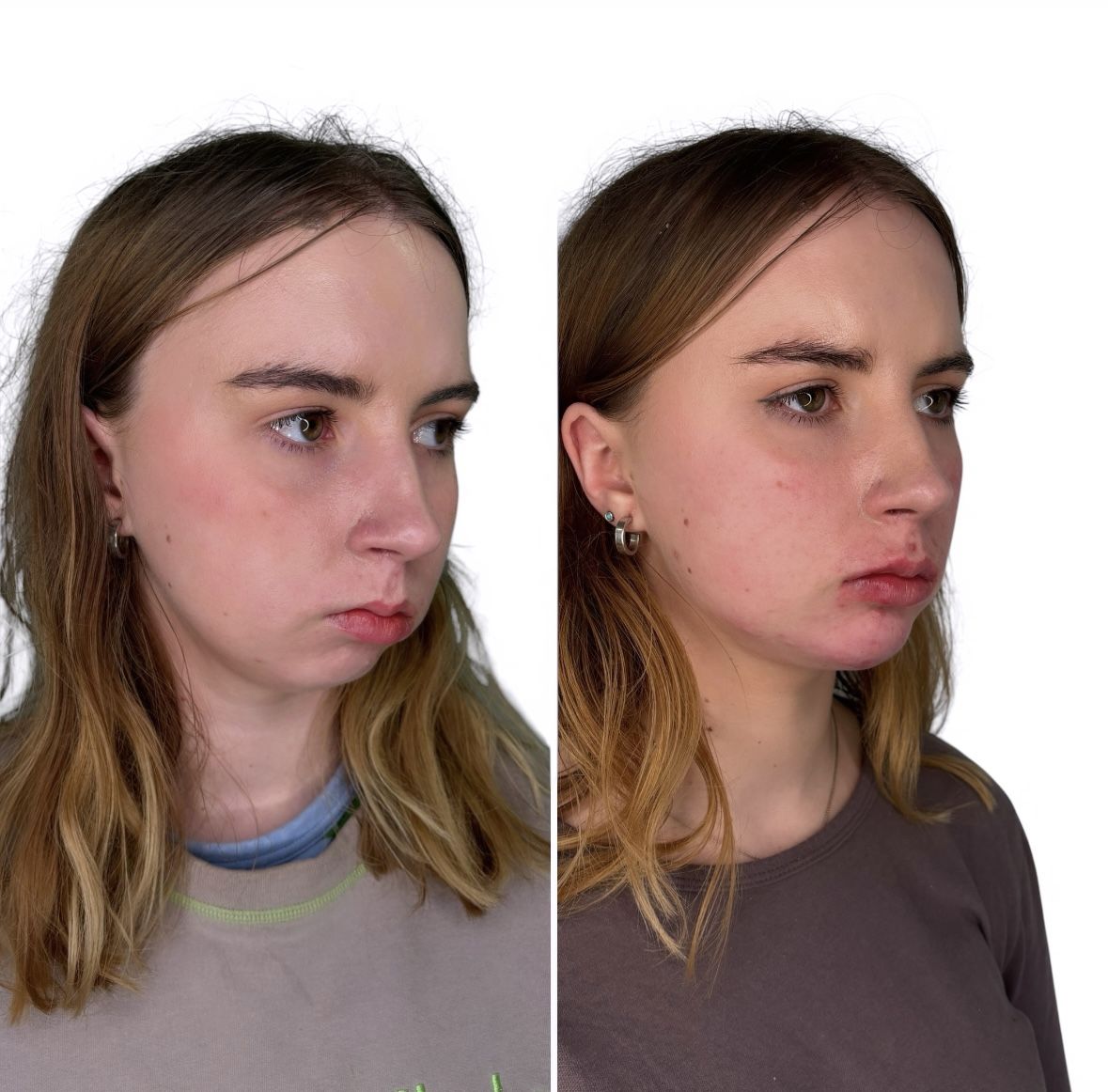 Before and after beautification