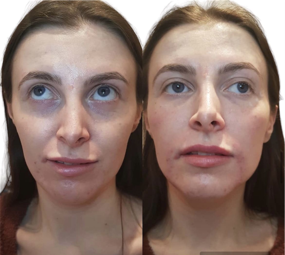 Before and after beautification