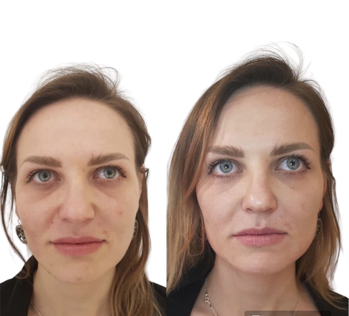 Before and after beautification