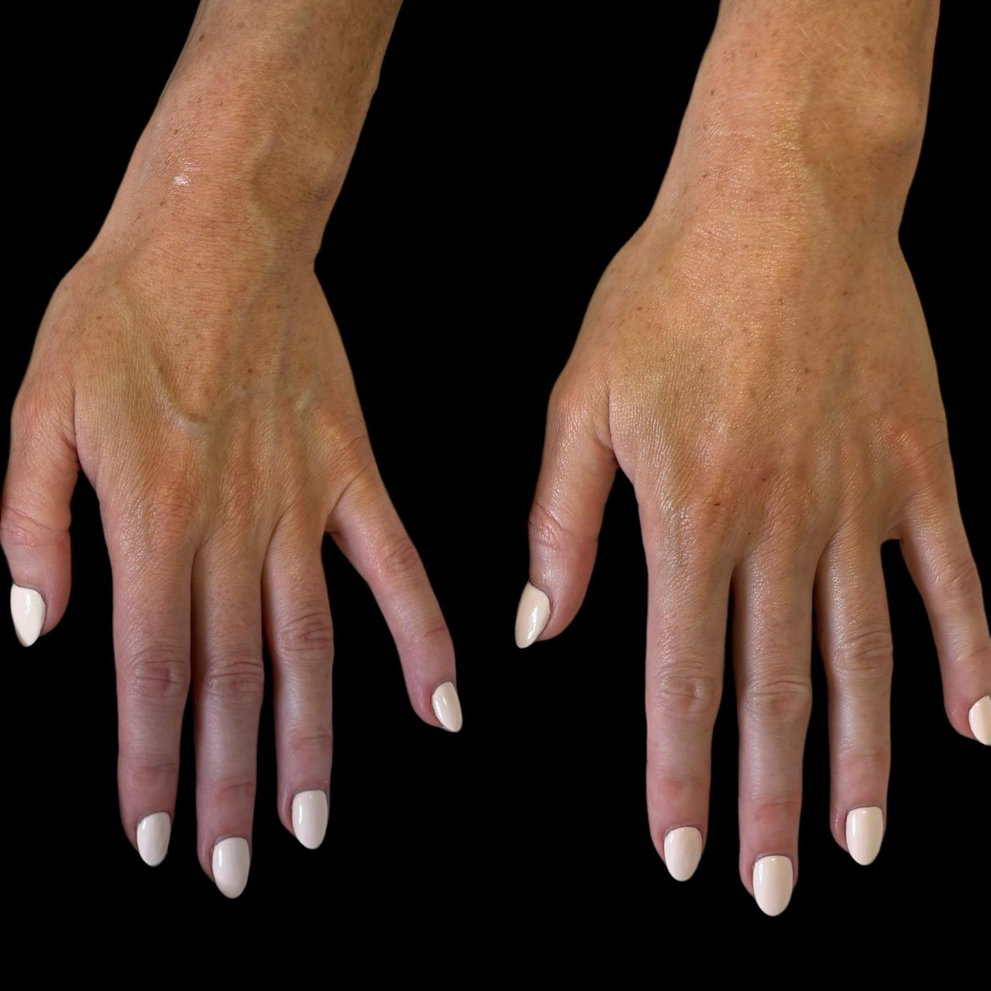 Before and after hands