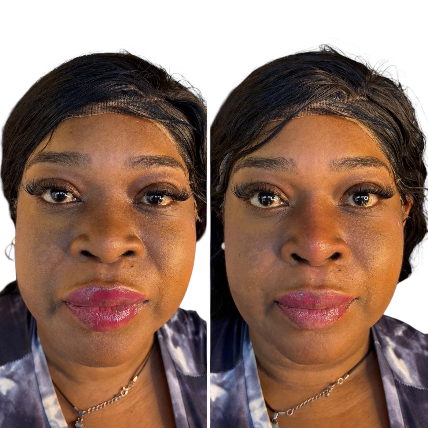 Before and after nose